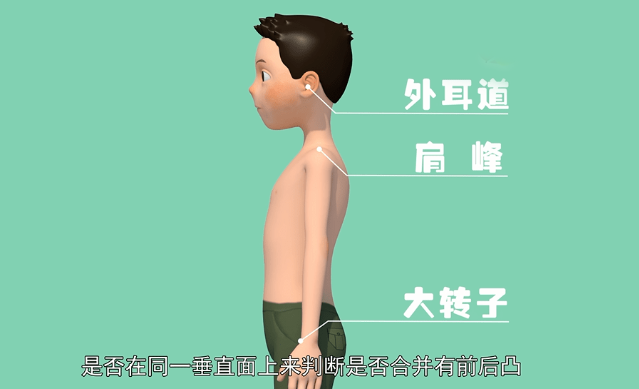 1736144452882413.png 男孩侧面图.png