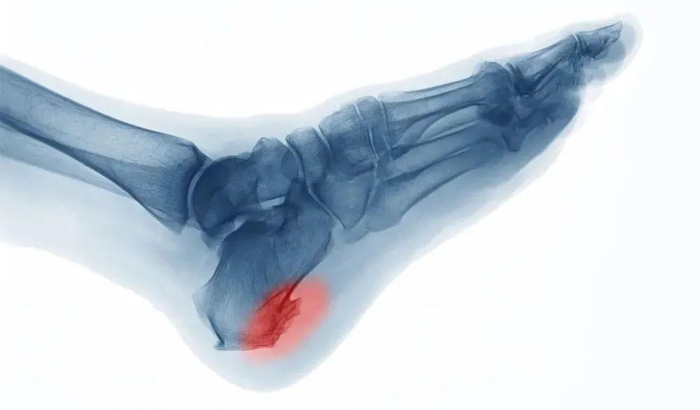 1740363259687420.jpg 07.jpg