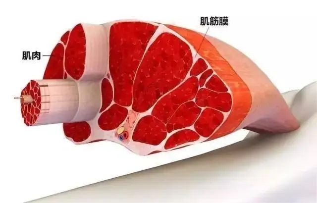 筋膜炎听起来不严重，却是很多人遭受疼痛折磨的根源